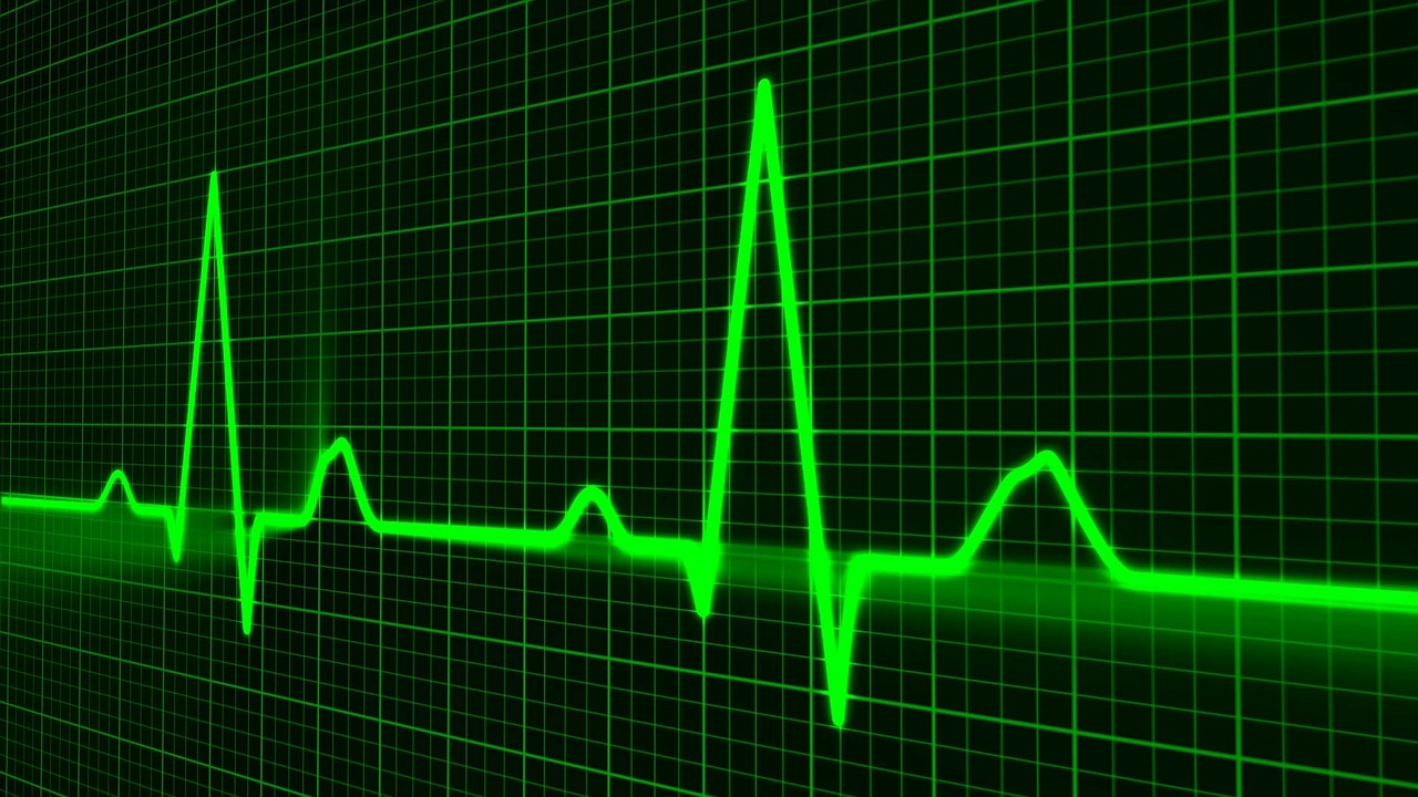 pulse trace 163708 1280
