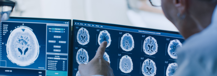 doctors pointing at brain scans on computer screen mobile